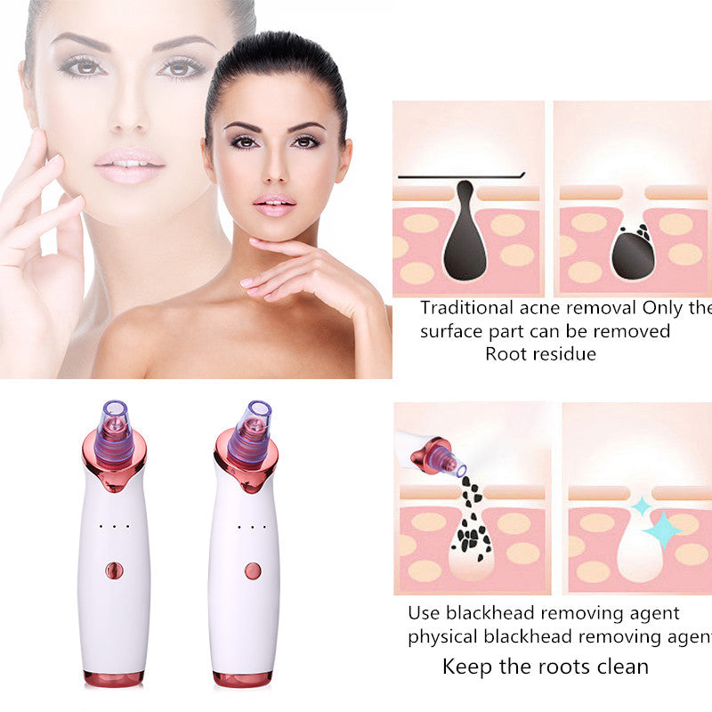 Blackhead Remover Vacuum Pore Cleaner Tool