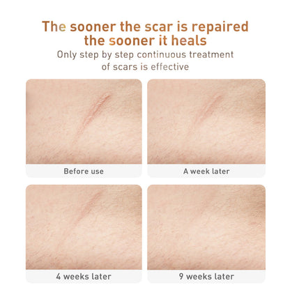 Traditional Chinese Medicine Scar Removal Cream