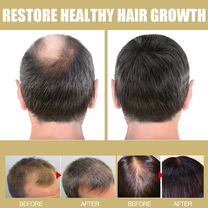 Houkea Toupee Hair Repair Heating Cap