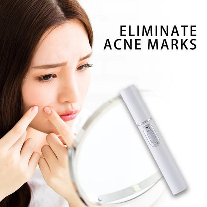Blue Light Acne Laser Pen